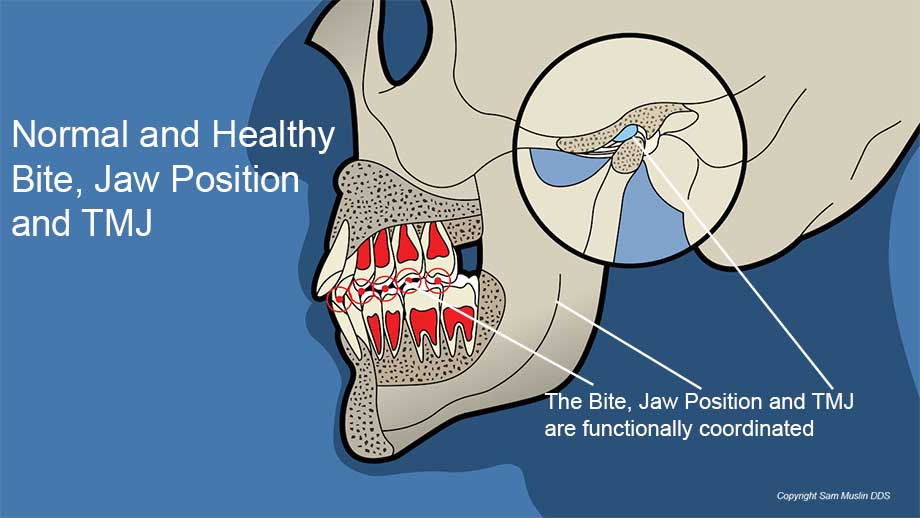 Illustration showing the TMJ and an optimal healthy bite and jaw position 