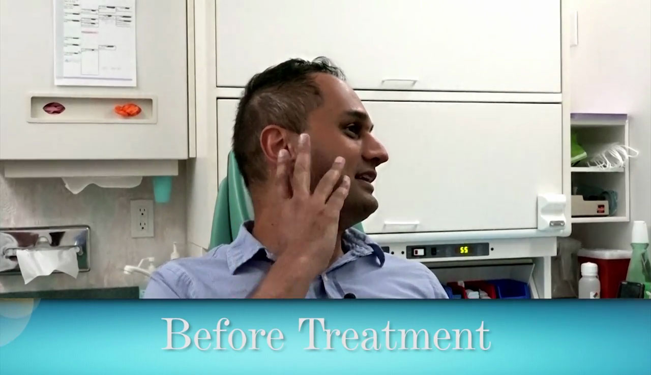 Deep Overbite Correction No Surgery, Braces or Tooth Grinding