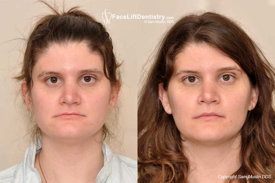 Going beyond braces and veneers with Venlay Restorations