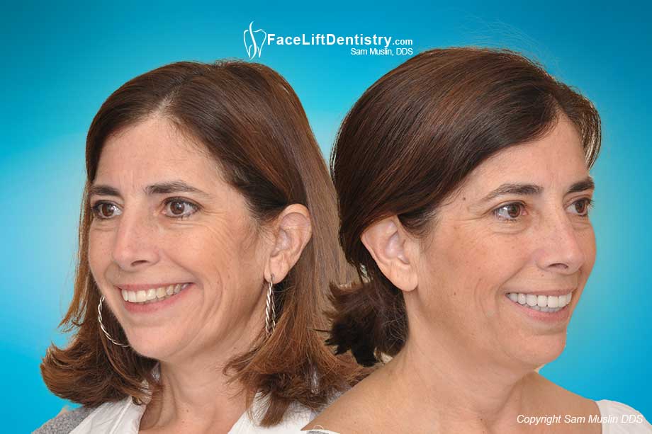 Neck and Jaw Tension Treated - Before and After