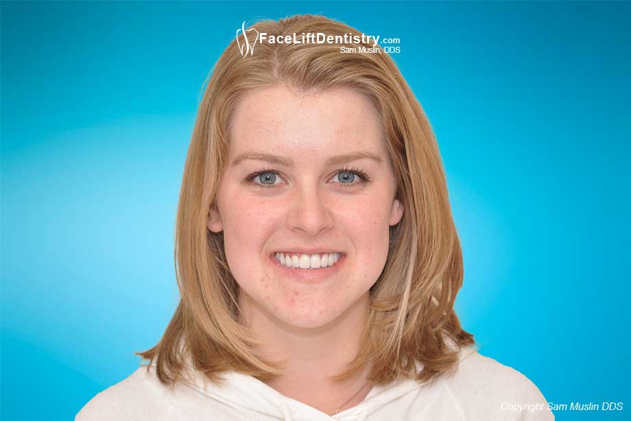 Bite Correction vs. Jaw Position Correction