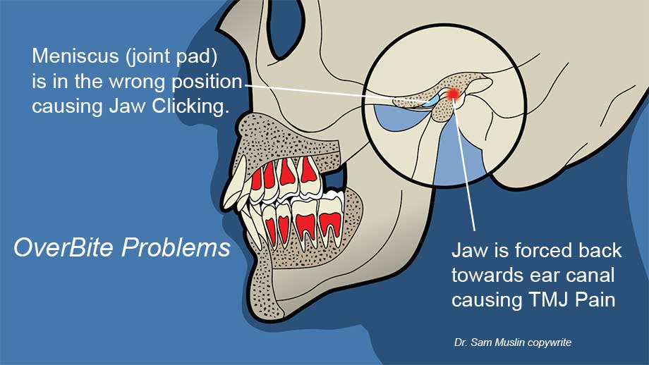 neuromuscular-dentistry-vs-jawtrac-jaw-positioning
