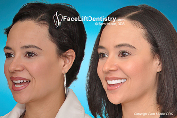 TMJ pain and facial stress treated.