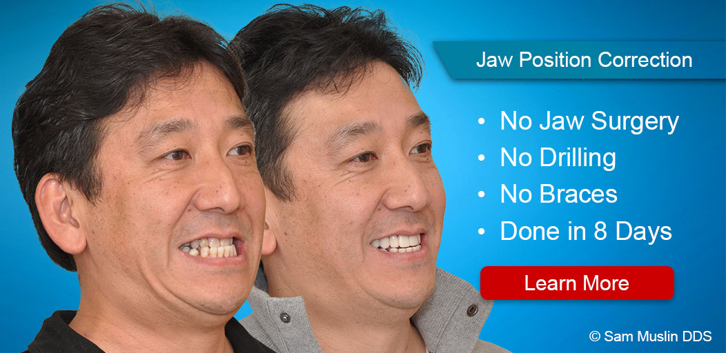 Jaw Position Correction Surgery Alternative