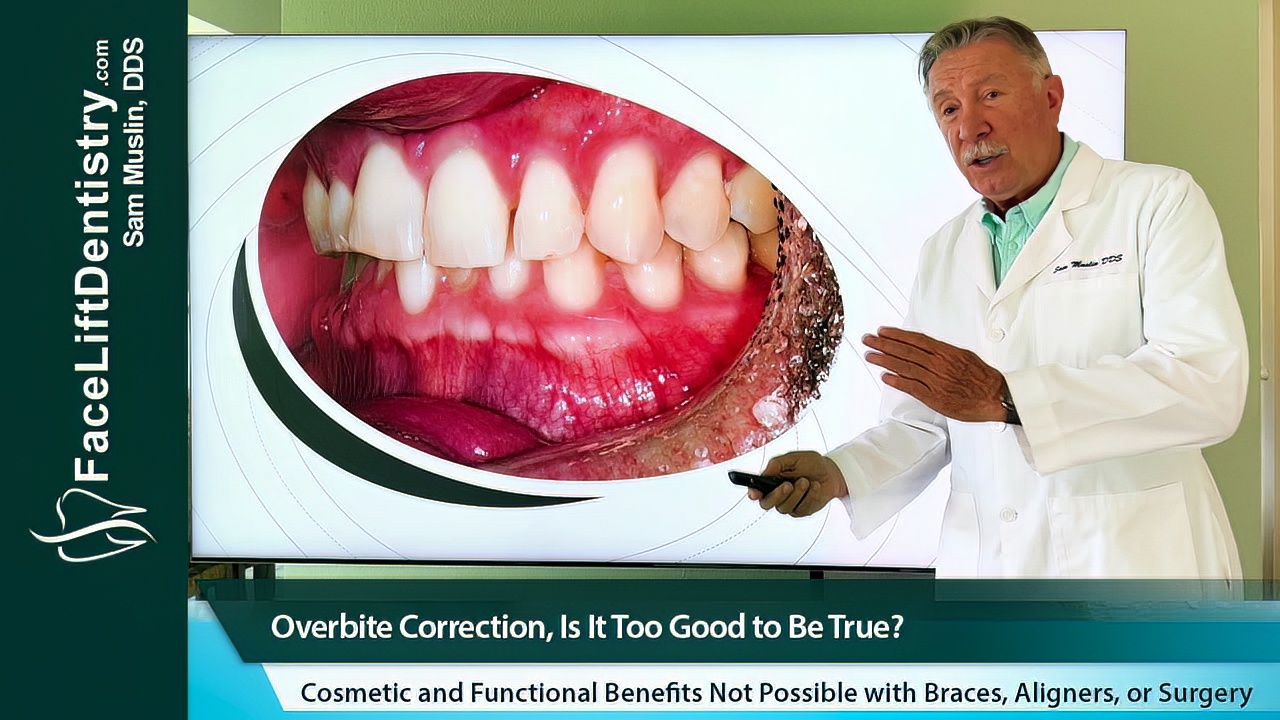 Non-Surgical overbite correction explained