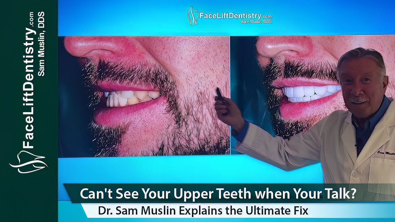 Upper Teeth Not Showing When Talking Explained