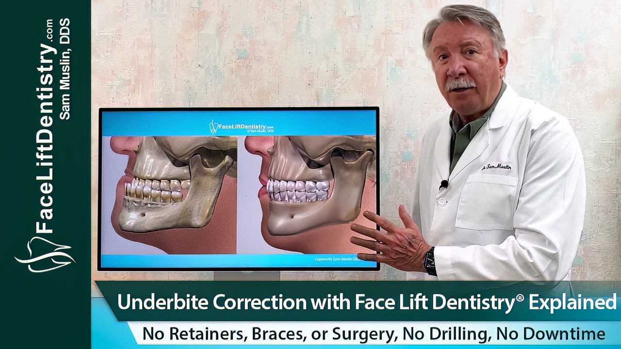Non-Surgical open bite correction explained