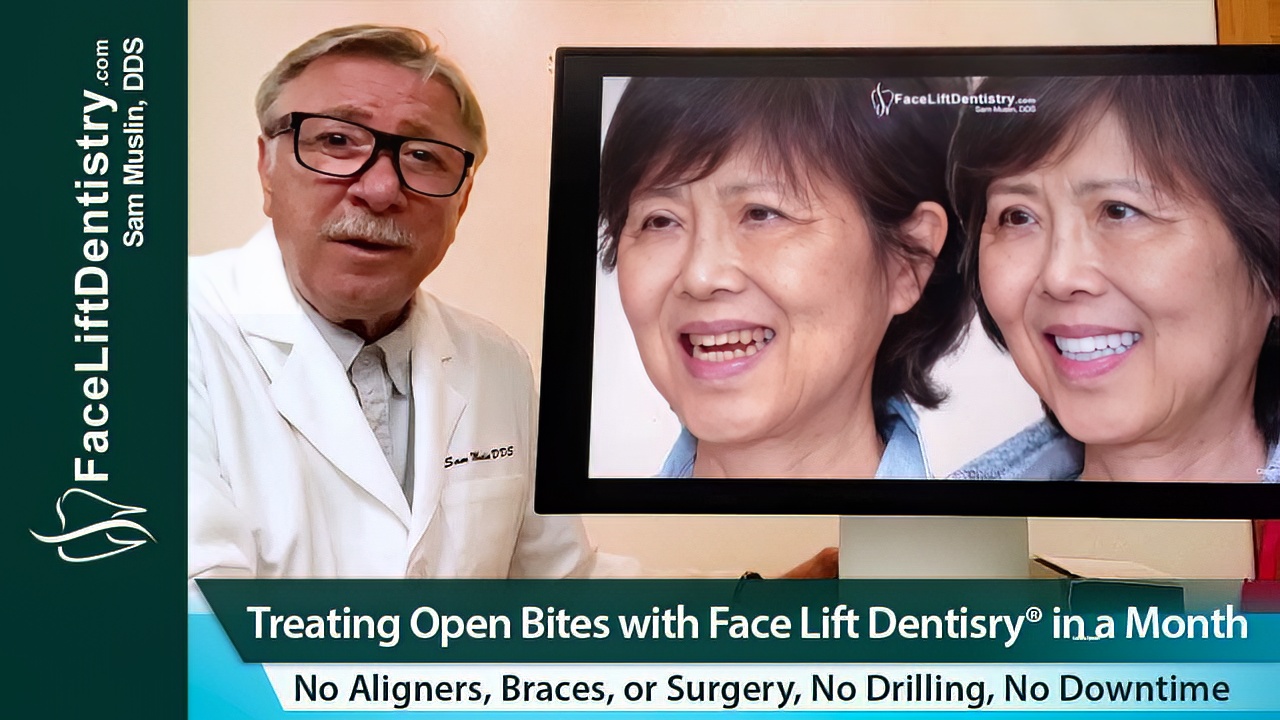 Non-Surgical open bite correction explained